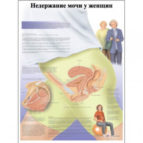 Недержание мочи у женщин