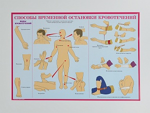 Комплект плакатов 'Первая медицинская помощь при чрезвычайных ситуациях' (А3, 10 листов)