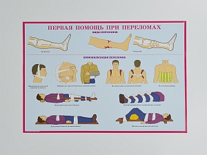 Комплект плакатов 'Первая медицинская помощь при чрезвычайных ситуациях' (А3, 10 листов)